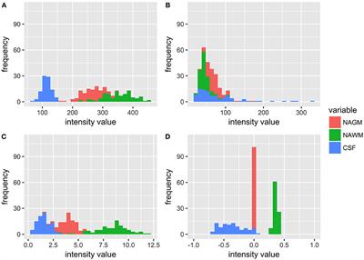 Standardization of T1w/T2w Ratio Improves Detection of Tissue Damage in Multiple Sclerosis